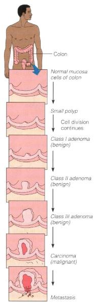 Diagram showing how cancer develops.