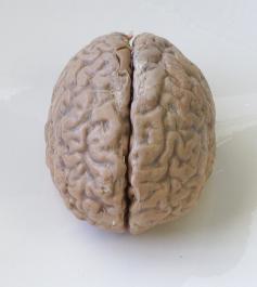 Picture of a human brain.