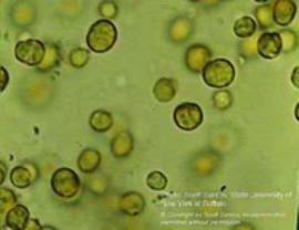 Picture of coral cells.