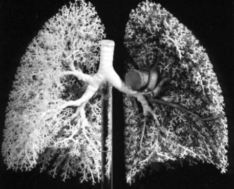Picture of a rubber cast of human lungs.