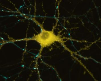 Picture of a nerve cell.