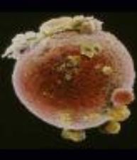 Picture of an ovum, or egg cell.