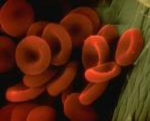 Picture of red blood cells.