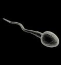 Picture of a sperm cell.